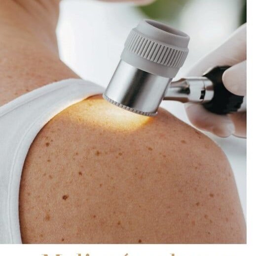 Dermatologické vyšetření znamének